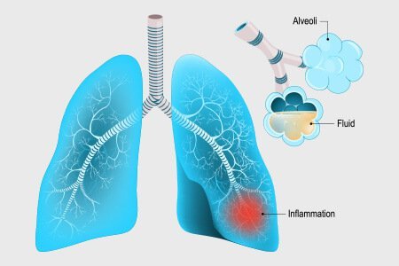 Respiratory System in Hindi