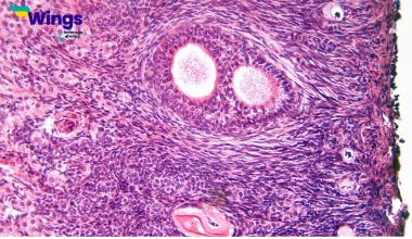 What is the Difference Between Ovary and Ovule
