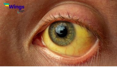 Which-Pollution-Causes-Jaundice