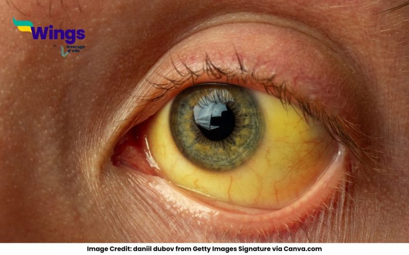 Which-Pollution-Causes-Jaundice