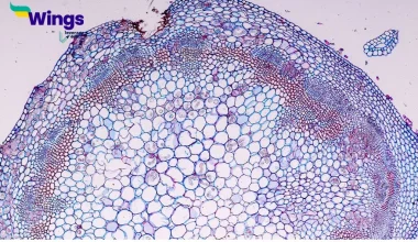four types of Phloem tissue
