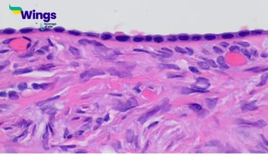 Germinal epithelium of ovary is composed of