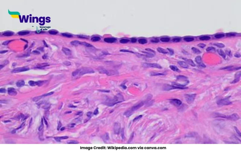 Germinal epithelium of ovary is composed of