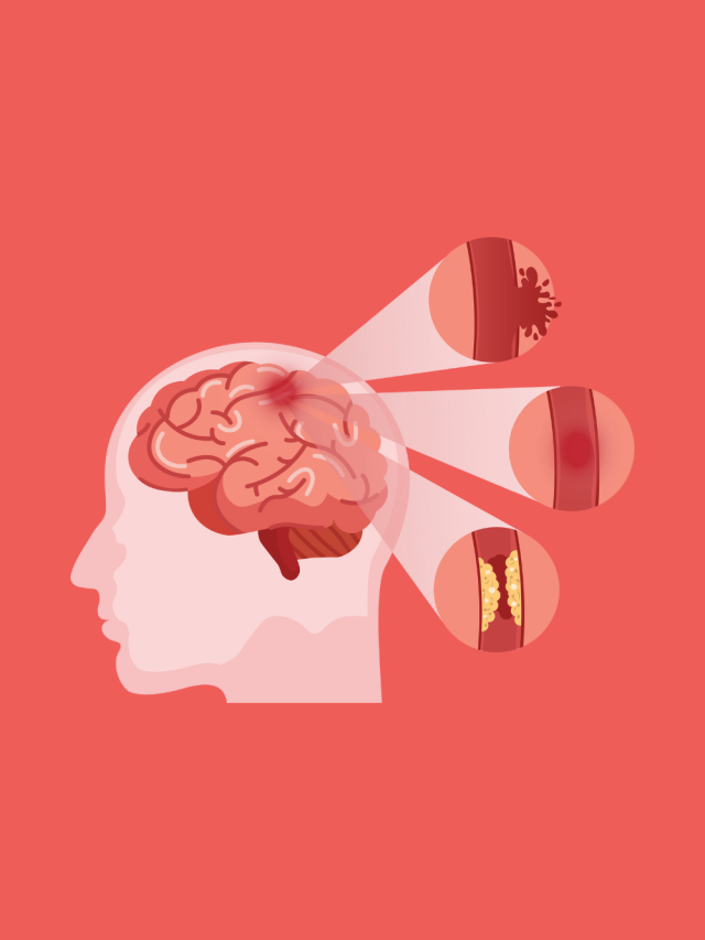 8 जून विश्व ब्रेन ट्यूमर दिवस